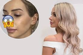 Married At First Sight Stacey Hampton's old nose has surfaced online