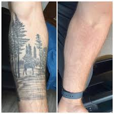 Explore the various pages of our site and you will learn a lot of interesting. No Regerts Removes More Than Tattoos Tattoo News