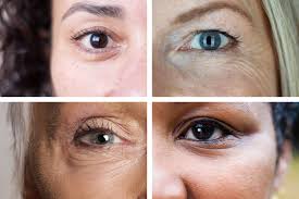 One of the most frequently asked beauty questions is how to cover up dark circles and bags under the eyes. The Fix For Dark Circles Bags And Droopy Lids The New York Times