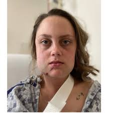 Fundraiser for Chrystal Johnson by Jennifer Spinks : Healing Hope for  Allison