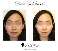 Pin On Cosmetic Surgery