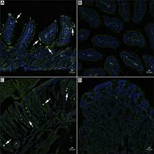 Image result for Blue 1999 AAV