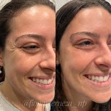 Fiona Nelson (@fionavierneza_np) • Instagram photos and videos