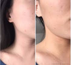 Theme by bundesweite webseiten manufaktur. Clarins Addition Concentre Eclat Auto Bronzant Radiance Plus Golden Glow Booster Selbstbrauner Ein Konzentrat Mit Einem Braune Effekt Von Clarins Radiance Plus Golden Glow Booster Ein Ebenmassiger Braunungston Ist Garantiert Testberichte
