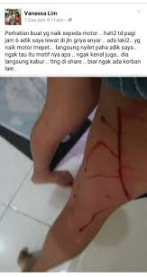 Maybe you would like to learn more about one of these? Aksi Silet Paha Seksi Beraksi Lagi Di Bali Polisi Edarkan Sketsa Wajah Dan Tangkap Pelaku Bonsaibiker