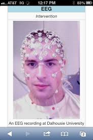 Is this a Frassati miracle? Fell 15 feet