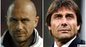 Antonio conte, attuale allenatore dell'inter, è tra i personaggi pubblici che non hanno fatto mistero di aver ricorso a un trapianto di capelli per . Antonio Conte S Haartransplantation Reise