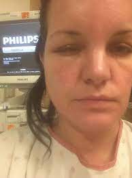 Ncis Star Pauley Perrette Lands In Hospital After Severe Allergic Reaction To Hair Dye Hair Dye Allergy Dyed Hair Pauley Perrette