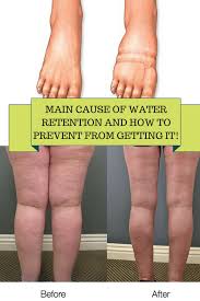 Pin On Health And Fitness