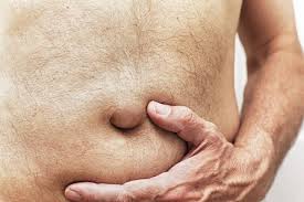 Image result for Inguinal hernia man