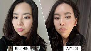 Or swirl them together for a quick easy glow. I Got Cheek Fillers For The First Time And Here S What It S Like Glamour