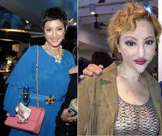 440 Plastic Surgery Ideas Plastic Surgery Surgery Cosmetic Surgery