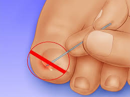 Pin On Health Tips