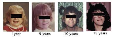 (1993) anästhesie und intensivtherapie bei autonomer dysfunktion. Hereditary Sensory And Autonomic Neuropathies Types Ii Iii And Iv Orphanet Journal Of Rare Diseases Full Text