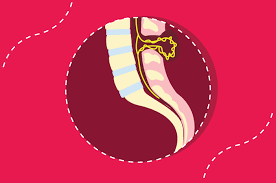 Tata laksana utama neural tube defect adalah pembedahan.pembedahan dapat dilakukan saat bayi masih di dalam kandungan atau setelah bayi lahir. Cara Pencegahan Spina Bifida Yang Perlu Diketahui Ibu Hamil