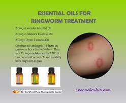 After ringworm clears, it's possible to get it again. Can Hand Sanitizer Kill Ringworm