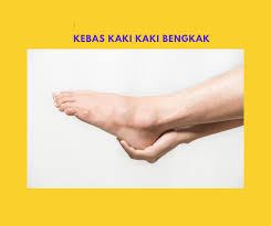 Penyebab gangguan itu adalah terganggunya bagian saraf tepi. Lotion Hilangkan Kebas Seawal 3 Hari Home Facebook