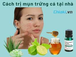 20+ cách trị mụn tại nhà hiệu quả sau 1 đêm - áp dụng mụn sưng,