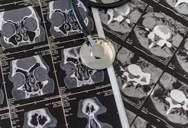 Image result for Cat Scan