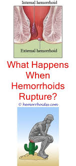 What Food Not To Eat After Hemorrhoid Surgery Hemorrhoid Remedies Cure For Hemorrhoids Bleeding Hemorrhoids