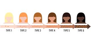 Image result for Fitzpatrick Skin Type