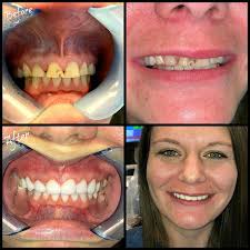 Smile Gallery, Satisfied Clients in Kannapolis, Concord and Mooresville