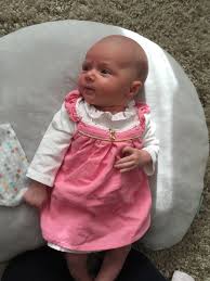 It is, in fact, a natural process where baby hair is replaced by permanent hair. Newborn Baby Hair Fall Newborn Baby