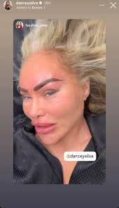 Darcy's Plastic Surgery Appearance