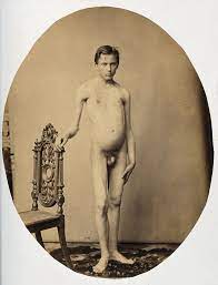 File:A naked young man, viewed from the front in full length; the Wellcome  V0029483.jpg - Wikimedia Commons