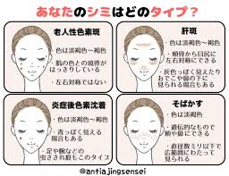 顔のシミを消す方法 自力で消したい人におすすめのケア法と食べ物 顔のシミ スキンケア用品 カオナシ