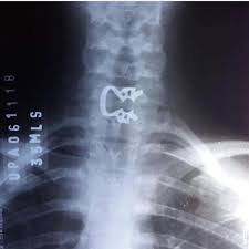 Dentaltown Uh Houston We Ve Had A Rubber Dam Clamp Problem Dentaltown Endodontics Https Www Dentaltown Com Me Dental Fun Dental Humor Esthetic Dentistry