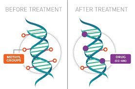 It's natural to feel a swirl of emotions,. Cc 486 Extends Survival Of Adults With Aml National Cancer Institute