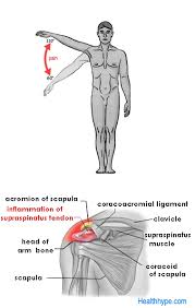 Related image