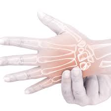 Image result for Extensor Tendon Laceration