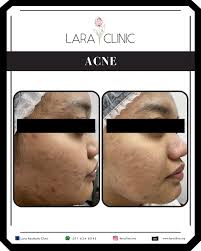 Lara Aesthetic Clinic