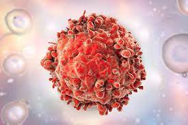 Leukemia symptoms vary widely, often depend on the type of leukemia involved and most who gets leukemia. Leukemia Cells Take The Fast Track To The Nervous System