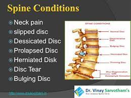 You'll learn the basics of requirejs and jasmine. Your Backbone Or Spine Is Made Up Of 26 Bone Discs Called Vertebrae The Vertebrae Protect Your Spinal Cord And Allow You To Stand And Bend Ppt Download