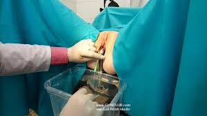 Amazing Gyno Exam: Hospital Fetish Porn by Gyn Club | xHamster