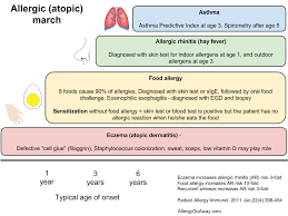 Allergic Atopic March Allergic Allergic Rhinitis Allergies