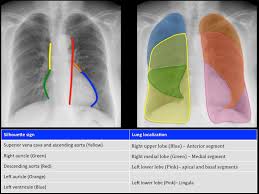 Image result for Silhouette Sign