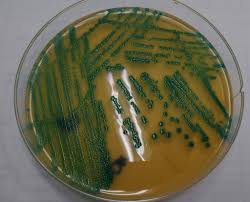 The new agar media differentiate l. M I C R O B I O L O G Y On Twitter Ù…ØªØ¹ Ù†Ø§Ø¸Ø±ÙŠÙƒ Listeria Monocytogenes On Aloa Agar
