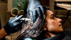 Ny metode mot hårtap hos kvinner