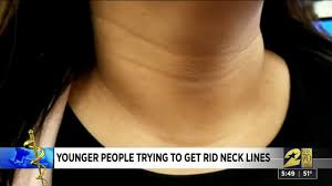 Explore the largest community of artists, bands, podcasters and creators of music & audio. How To Get Rid Of Tech Neck Creases In Your Neck That Aren T Caused By Age Youtube