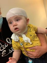 IT WORKED! Gilbert's helmet worked! Sometimes when a baby sleeps in the  same position, the soft plates in their skull may develop a flat spot or  uneven appearance. I will remind him