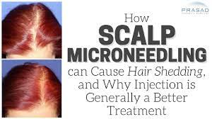 If the inflammation is left untreated, it will lead to the miniaturization of the hair follicle which ultimately causes shedding and hair loss. How Scalp Microneedling Can Cause Temporary Hair Shedding And Advantages Of Injection Treatment Youtube