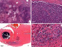 Image result for Rhodococcus equi