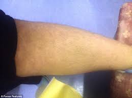 Wet your skin with warm water and use shaving gel shave in the direction the hairs are growing use as few strokes of the razor as possible rinse the razor after every stroke Bearded Mother Who Shaves Face Three Times A Day Gets Nhs Hair Removal Daily Mail Online