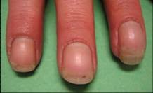 We did not find results for: Rochester Hand Center Systemic Diseases