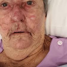 Fundraiser by Michelle Fernance : Everything lost in Rental Property House  Fire MARSDEN 4132