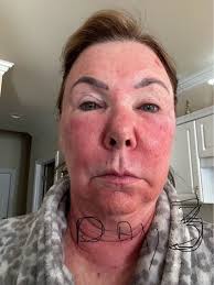 I am happy with results thus far